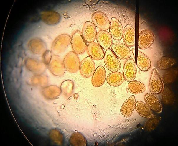 Spores of southern rust appear elongated vs. common rust appear as near perfect circles.